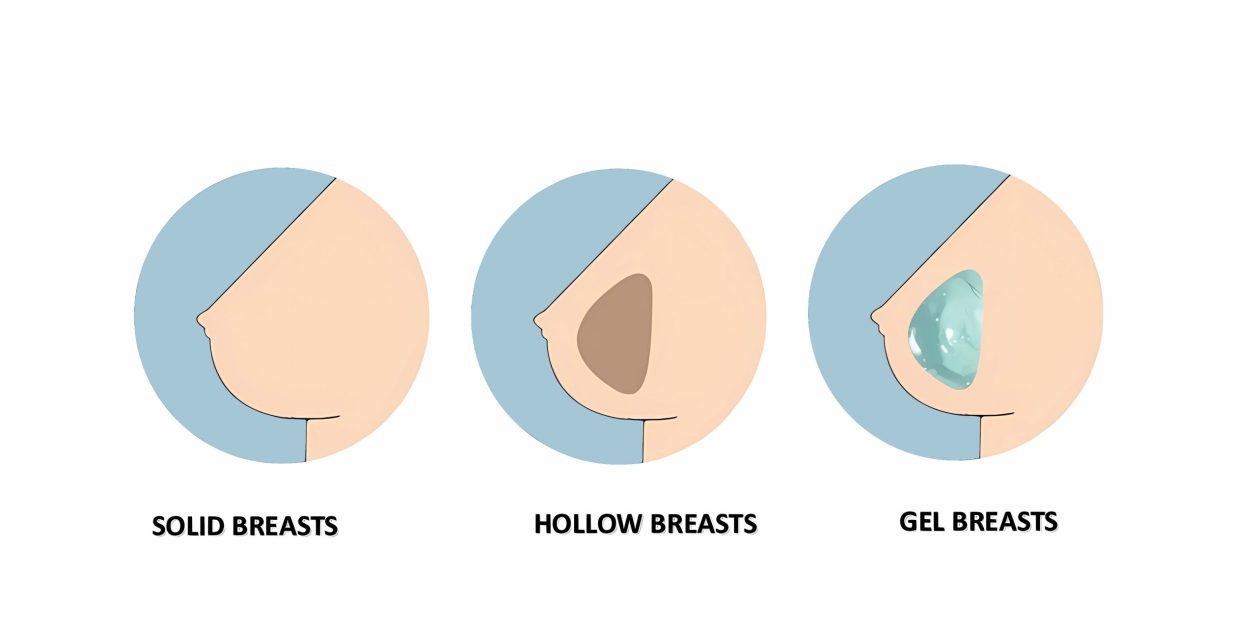GEL HOLLOW SOLID