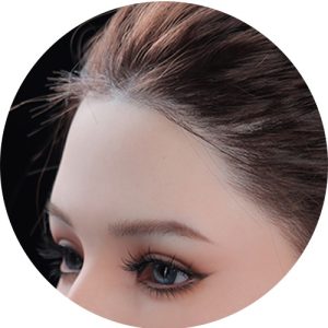 Implantation de Cheveux Réalistes